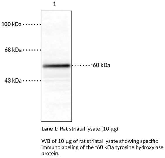 Anti-Tyrosine Hydroxylase (rat, native)