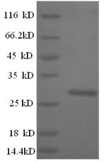 Cathepsin K (Ctsk), mouse, recombinant