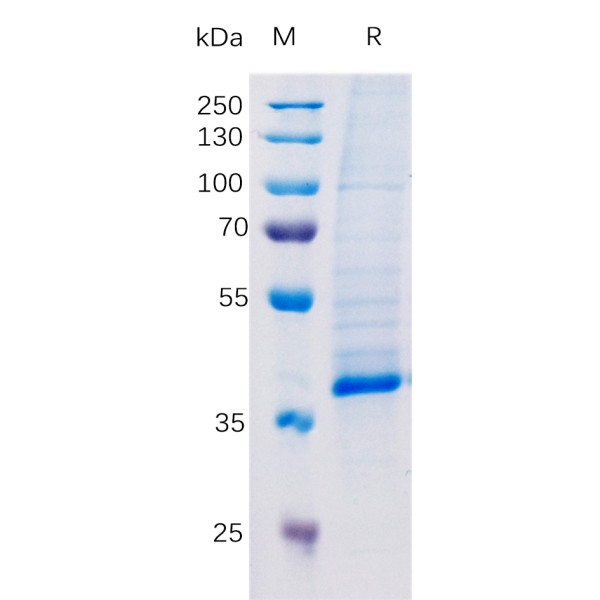 Human TGFB1 Protein, hFc Tag