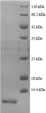 Peptide YY (PYY), partial, human, recombinant