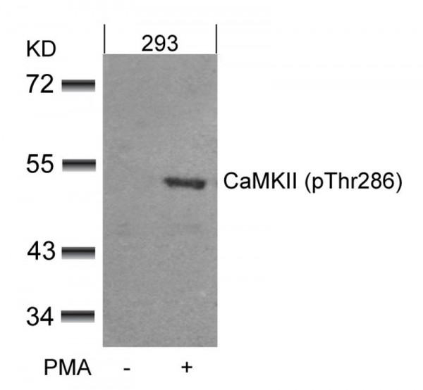 Phospho-CaMKII Antibody Duo