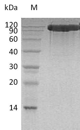 Angiotensin-converting enzyme 2 (ACE2), partial (Active), human, recombinant