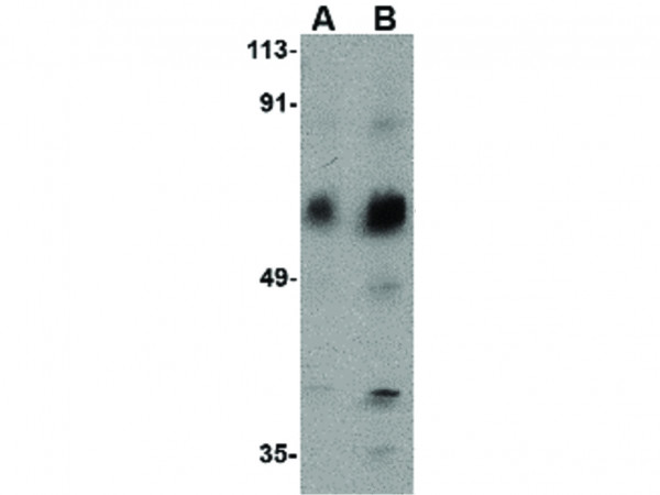 Anti-ACVR1C