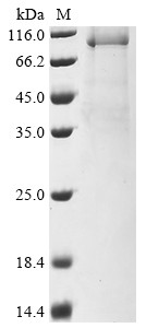 DNA polymerase theta (POLQ), partial, human, recombinant