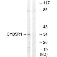 Anti-CYB5R1