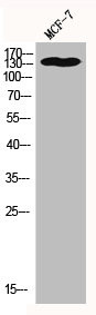 Anti-HDAC6