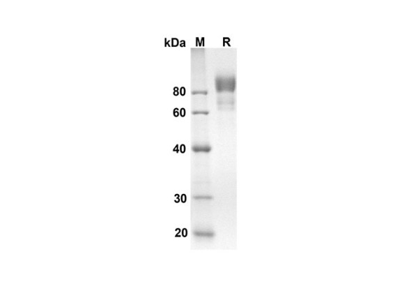 CD6 Protein (Fc Tag) (recombinant mouse)