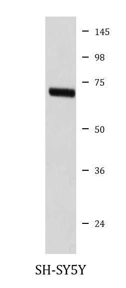 Anti-5-HT2C Receptor