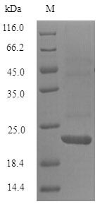 B-lymphocyte antigen CD20 (Ms4a1), partial, mouse, recombinant