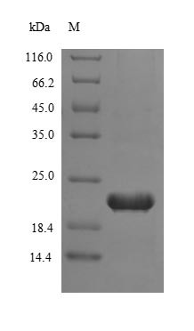 Telomerase reverse transcriptase (TERT), partial, human, recombinant