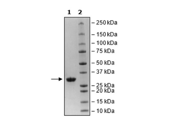 3CL Protease (T21I, A173V, T304I), (SARS-CoV-2) Recombinant