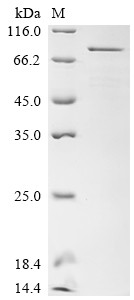 Transcriptional coactivator YAP1 (YAP1), human, recombinant