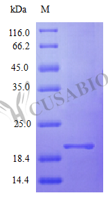 Interferon alpha-2 protein (IFNA2), partial (Active), human, recombinant