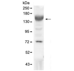 Anti-IGF1 Receptor / IGF1R