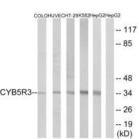 Anti-CYB5R3