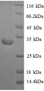 Vasopressin V1a receptor (Avpr1a), partial, rat, recombinant