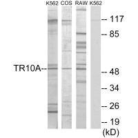 Anti-TNFRSF10A