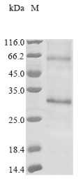 Adiponectin receptor protein 1 (ADIPOR1), partial, human, recombinant