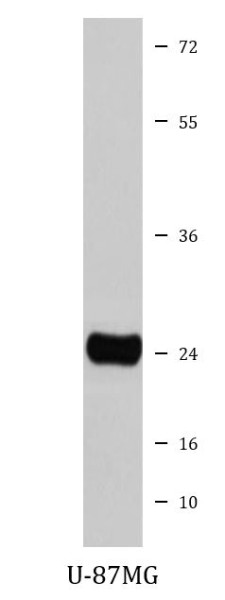 Anti-Cathepsin S