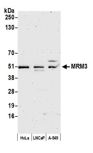 Anti-MRM3