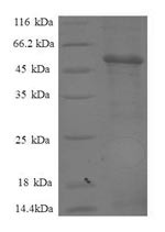 Proteasome subunit beta type-7 (PSMB7), partial, human, recombinant