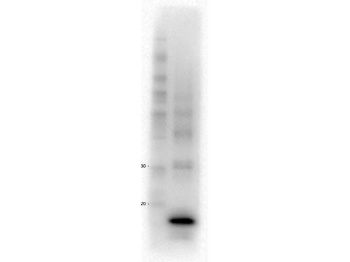 Anti-Procalcitonin, clone 4D12.D4.F3.E2.H7.E7