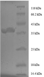 Peptidyl-prolyl cis-trans isomerase FKBP1A (FKBP1A), partial, human, recombinant