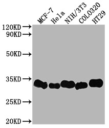 Anti-LGALS3 Recombinant Monoclonal, clone 4E1