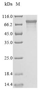 ORC ubiquitin ligase 1 (OBI1), partial, human, recombinant