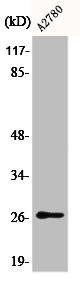 Anti-Phospho-CDKN1B (S10)