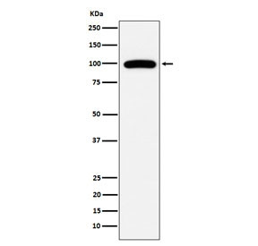 Anti-CD10 / Neprilysin, clone AFGB-13