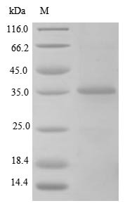 Transforming growth factor beta-1 proprotein (Tgfb1), partial, rat, recombinant