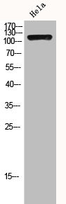 Anti-HDAC4