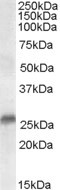 Anti-SRD5A2 / 5-alpha reductase 2, N-terminal