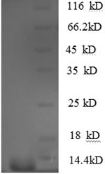 C-C motif chemokine 5 (CCL5), human, recombinant