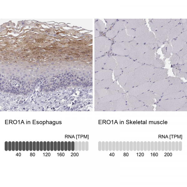 Anti-ERO1A