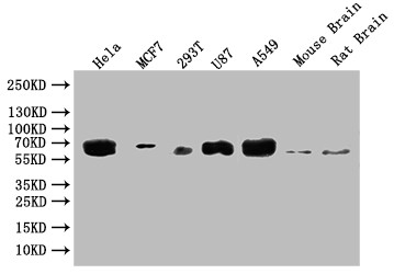 Anti-GBA Recombinant Monoclonal, clone 4H4