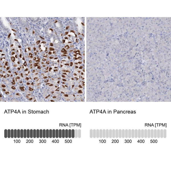 Anti-ATP4A