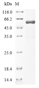 Cellular tumor antigen p53 (TP53), human, recombinant