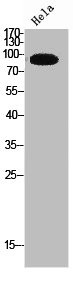 Anti-TRPC3