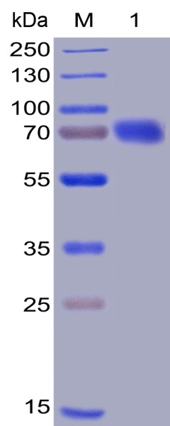 Human CD28 Protein, mFc-His Tag