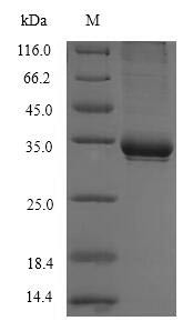 T-cell surface glycoprotein CD1c (CD1C), partial, human, recombinant