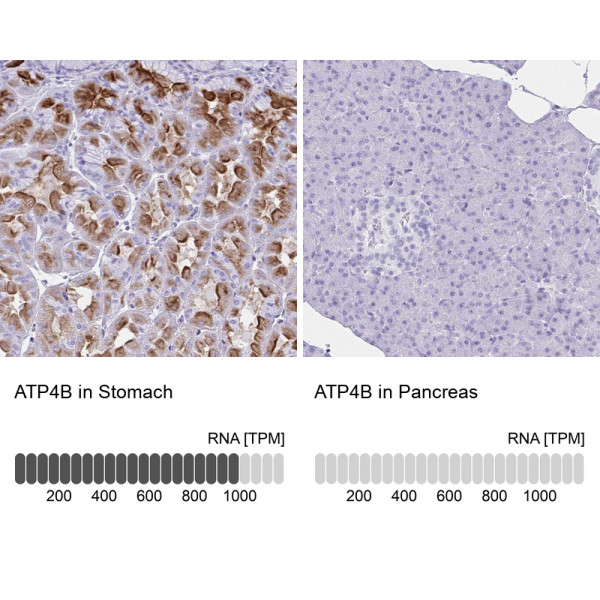 Anti-ATP4B