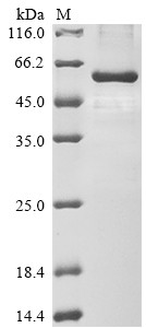 Paired box protein Pax-6 (PAX6), human, recombinant