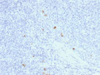 Anti-IgG4 (Ig Heavy Constant Gamma 4) (G4m Marker) Recombinant Mouse Monoclonal Antibody (clone:rIGH