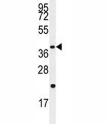 Anti-Caspase-9