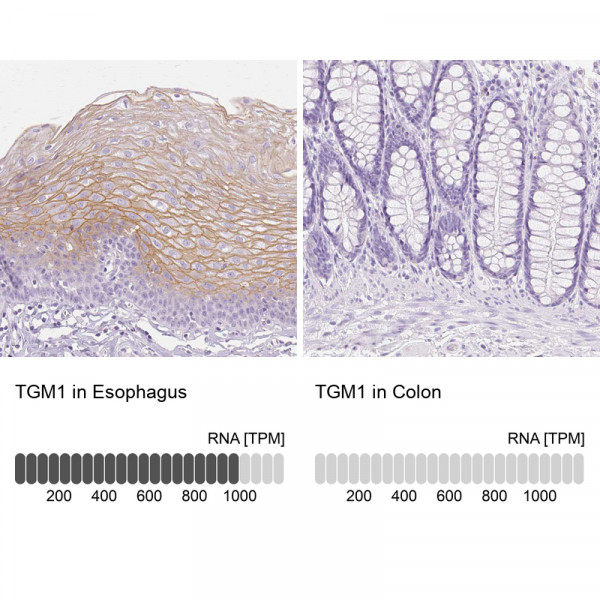 Anti-TGM1