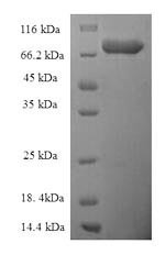 Epoxide hydrolase 2 (EPHX2), human, recombinant