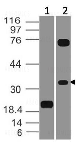 Anti-VISTA (Clone: ABM1F9.1F6)