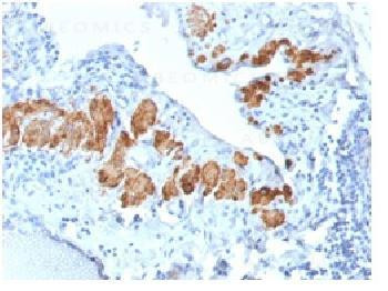 Anti-Smooth Muscle Myosin Heavy Chain (SM-MHC) Recombinant Rabbit Monoclonal Antibody (clone:MYH11/2